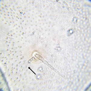 Fig. 9.  High magnification view of the posterior abdominal integument of the mature caterpillar of tomato pinworm (Keiferia lycopersicella). The arrow indicates microgranules bearing short microsetae, covering the integument in this area. Photo by permission from Hayden et al. (2013). http://idtools.org/id/leps/micro/factsheet.php?name=%3Cem%3EKeiferia+lycopersicella%3C%2Fem%3E