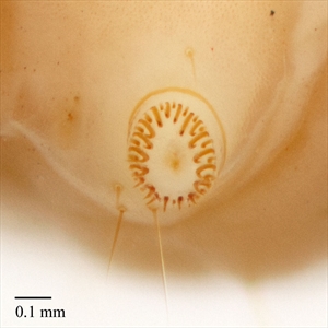 Fig. 2. Crochets (multiordinal and arranged in a circle) on the ventral proleg of a mature caterpillar of carob moth Ectomyelois ceratoniae (Pyralidae: Phycitinae)). Photo from Gilligan and Passoa (2014).