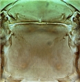 Mesonotum and metanotum of short-winged female
