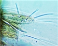Forewing sub-basal setae