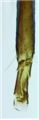 Hind tibia and tarsus