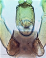 Male head and pronotum