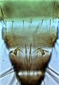 Female sternite VII and reduced ovipositor